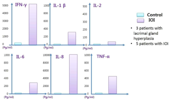 Comparison of inflammatory cytokine concentrations in lacrimal gland tissue