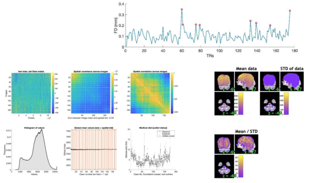 resting-state functional MRI의 영상 적절성 평가