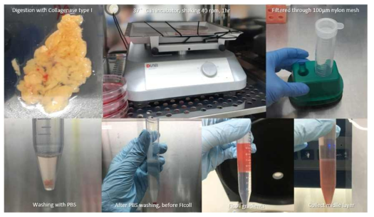 Human omentum-derived stem cells(OMSCs) isolation by Ficoll gradient centrifugation