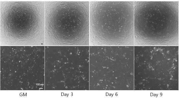 Phase-contrast image of 2D parathyroid differentiation of passage#4 cells