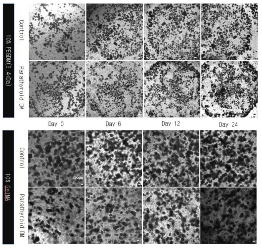 3D Culture for parathyroid differentiation