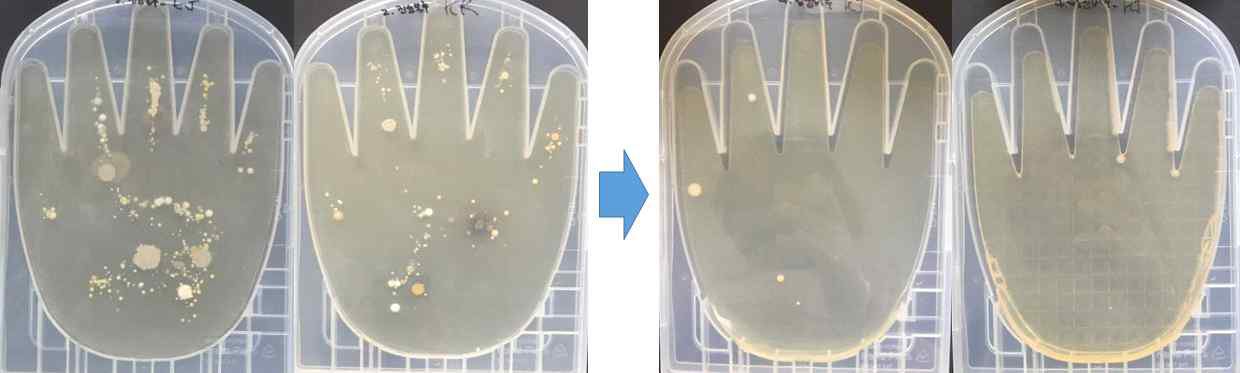 진료 글러브 재사용 미생물 변화