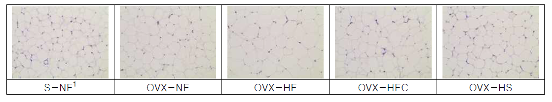 Adipocytes size (H OVX-NF, ovariectomized mice fed with normal fat diet; OVX-HF, ovariectomized mice fed with high fat diet; OVX-HFC, ovariectomized mice fed with high fat/cholesterol diet; OVX-HS, ovariectomized mice fed with high sucrose diet