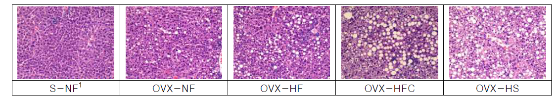 Fat accumulation (H  OVX-NF, ovariectomized mice fed with normal fat diet; OVX-HF, ovariectomized mice fed with high fat diet; OVX-HFC, ovariectomized mice fed with high fat/cholesterol diet; OVX-HS, ovariectomized mice fed with high sucrose diet