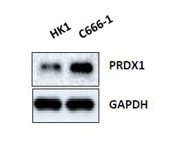 EBV음성 비인두암 세포주 HK1 세포와 EBV양성 비인두암 세포주 C666-1 세포사이의 증식과 관련있는 PRDX1 단밸질 발현차이분석