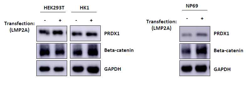 비인두암세포주에 LMP2A를 형질주입하면 새로운 표적물질인 PRDX1과 beta-catenin의 발현이 함께 증가함을 볼 수 있음. 비인두상피세포주인 NP69에서도 동일한 증가를 확인함