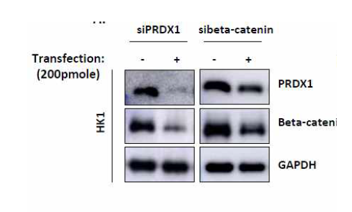 HK1 비인두암세포주에서 siRNA를 이용한 억제실험에서 PRDX1과 beta-catenin 상호 억제 실험결과