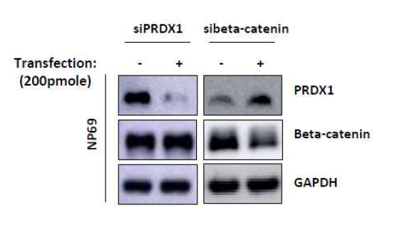 NP69 비인두상피세포주에서 siRNA를 이용한 억제실험에서 PRDX1과 beta-catenin 상호 억제 실험