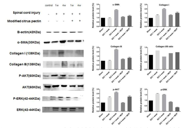 Modified citrus pectin 투여 후 신경인성방광의 섬유화 표지자 분석 및 pathway 확인 (by western blot)