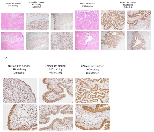 척수손상모델 신경인성방광 백서와 대조군의 방광에서 Galectin-3 의 면역염색결과 및 H-E stain 결과