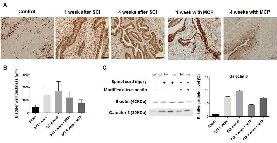 신경인성방광 백서모델에서 Galectin-3 inhibitor (modified citrus pectin)을 치료제로 사용 시 방광의 변화