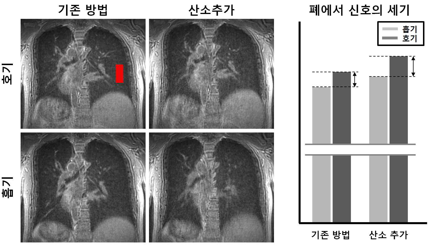 산소를 추가하지 않은 기존방법과 산소를 추가한 방법으로 촬영한 흡기, 호기 단계의 폐 MR 영상(왼쪽)과 폐에서 신호의 세기를 측정한 결과 그래프(오른쪽)