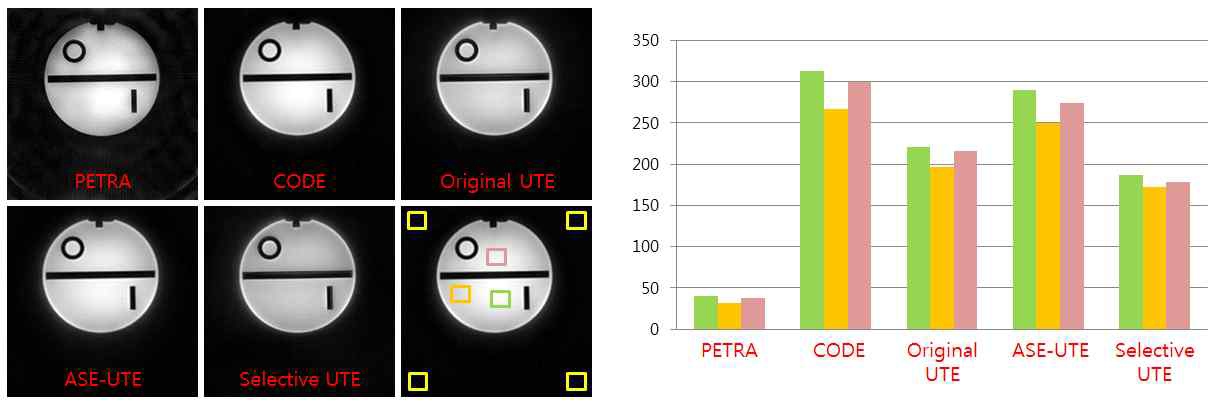 5가지 3차원 UTE 영상기법들을 통해 획득한 ACR phatom의 영상(왼쪽)과 SNR 비교(오른쪽)