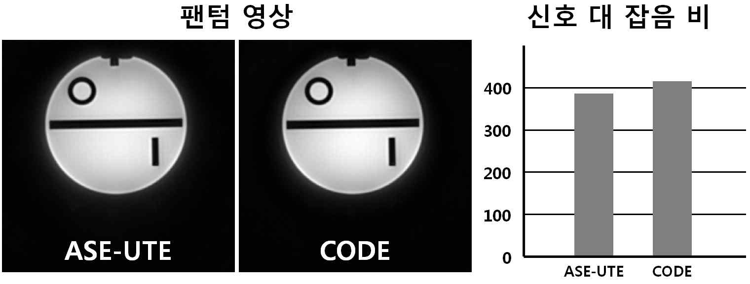 ASE-UTE와 CODE을 통해 획득한 ACR phatom의 영상(왼쪽)과 SNR 비교(오른쪽)