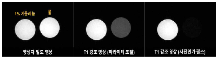 1% 가돌리늄(Gadolinium)과 물 팬텀에서의 양성자 밀도 영상, 파라미터 조절을 통한 T1 강조 영상, 그리고 사전인가 펄스의 적용을 통한 T1 강조 영상. 사전인가 펄스 적용의 경우 T1 강조가 향상됨을 확인할 수 있음. T2 강조영상 추가