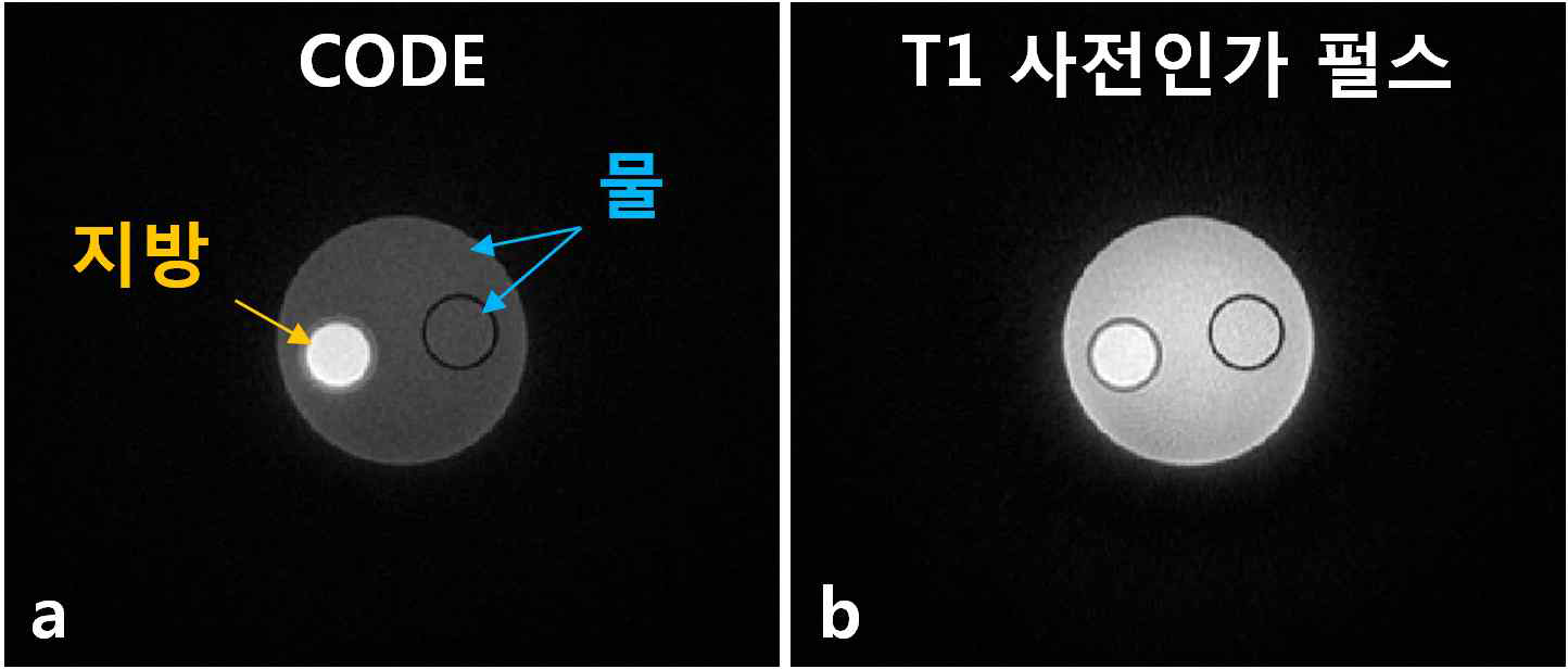 지방과 물 팬텀에서의 CODE 영상과 T1 사전인가 펄스를 적용한 영상(a : CODE, b : T1 사전인가 영상)