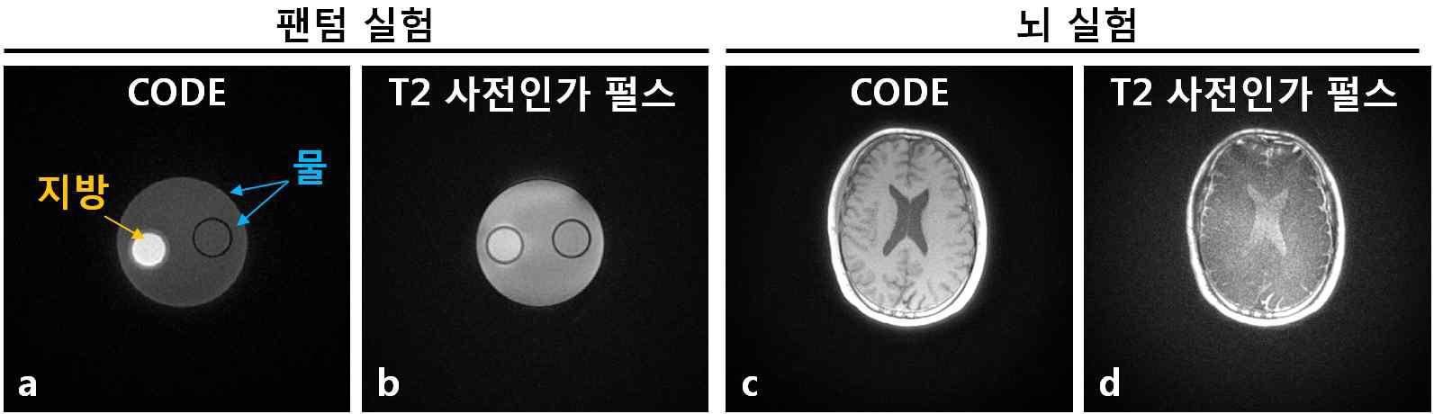 지방과 물 팬텀에서의 CODE 영상과 T2 사전인가 펄스를 적용한 영상(a : CODE, b : T2 사전인가 영상), 인체 내 뇌 영상을 CODE와 T2 사전 인가 펄스를 적용한 영상 (c : CODE, d : T2 사전인가 영상). 사전인가 펄스를 적용하였을 때 지방의 신호가 억제되고 물의 신호가 증가하는 결과를 획득할 수 있으나 SNR 문제로 인해 유효성이 떨어짐을 확인함