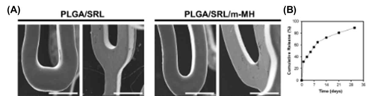 (A) 코팅된 생체흡수성 혈관지지 구조체의 표면 사진 및 (B) SRL 약물 방출 거동