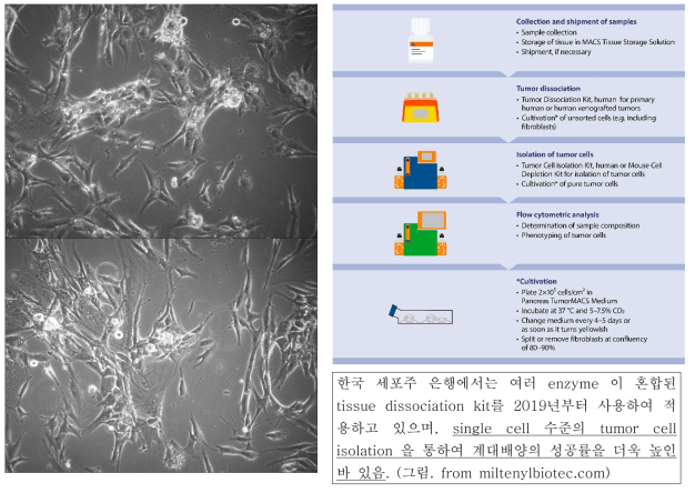 계대배양 중인 환자유래 방사선 유발 육종 세포의 현미경 사진. (SNU-5993A, SNU-5993B)