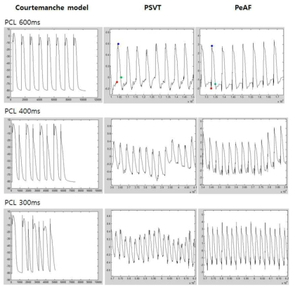 활동전위를 Pacing cycle length (PCL)별로 부분 확대한 데이터. (오른쪽) Baseline Courtemanche 시뮬레이션 모델, (가운데) 임상에서 측정한 PSVT 환자의 단상활동전위와 (왼쪽) PeAF 환자의 단상활동전위