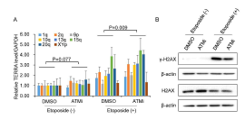 ATM 억제는 DNA 손상에 따른 TERRA 증가 유발. A. ATM 억제제와 etoposide 함께 처리한 세포에서 TERRA 발형양 조사. ATM 억제제인 KU55933 (‘ATMi’) 또는 DMSO를 2 h 처리한 후 etoposide 를 2 h 처리한 HeLa 세포에서 RT-qPCR 수행함. 대조군으로 etoposide 처리하지 않은 세포를 이용함. 3번 독립실험으로부터 결과를 분석함. student t test. B. ATM 억제제와 etoposide 함께 처리한 세포에서 γ-H2AX 와 H2AX를 검출함