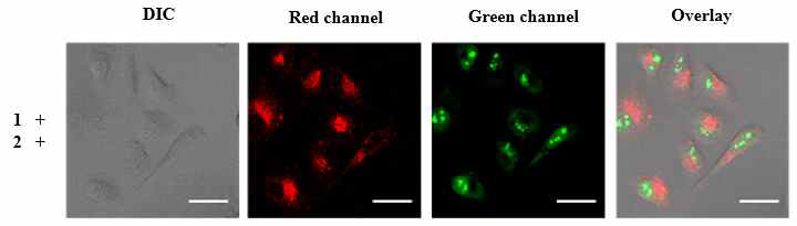 형광현미경을 통한 재조합 단백질 발현 확인