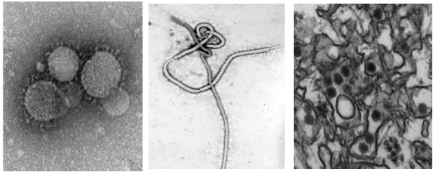 (A) Middle East respiratory syndrome coronavirus (MERS-CoV). MERS-CoV particles as seen by negative stain electron microscopy. Virions contain characteristic club-like projections emanating from the viral membrane. (B) Ebola virus. (C) Zika virus