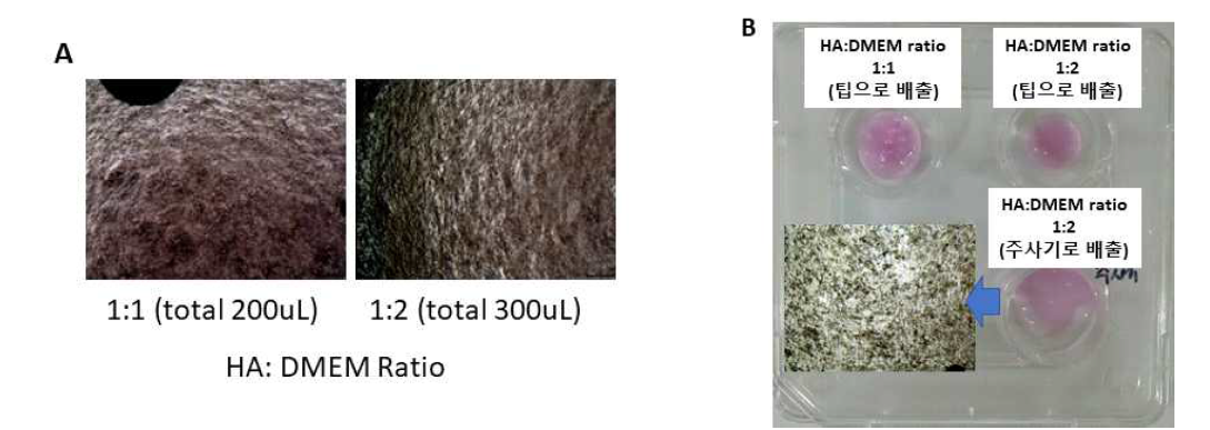 1×106의 TMSC를 HA:DMEM의 비율을 1:1 (total 200uL) 그리고 1:2 (total 300 uL)로 혼합하여 (A) 세포와 HA의 혼합력을 현미경으로 관찰한 결과. (B) 파이펫팁과 주사기로 배출 뒤의 형태를 조사한 결과