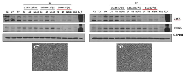 편도줄기세포 유래 부갑상선분비세포의 유효성 평가. C7과 D7실험군의 세포를 저농도(L)와 고농도(H)의 칼슘(Ca2+)에 노출시켜 부갑상선분비 조절이 가능한지 확인. C0, 0 days after culture with growth medium; C7  D7  D7  CHGA, chromogranin A; CASR, calcium-sensing receptor; HK2, human proximal renal tubular epithelial cells; h_P, human parathyroid adenoma