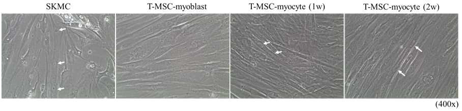 마이크로어레이 분석 전, 엑소좀 추출에 사용된 세포들. 화살표: myotube형태, 다핵세포를 가리킴