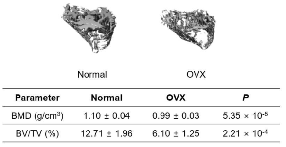 Normal 그리고 OVX-mice의 대퇴골 bone mass density (BMD), bone volume (BV)/ total volume (TV)를 측정한 결과. (각 그룹당 n=10)