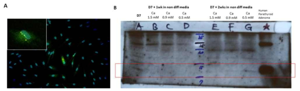 TMSC를 각각 100 ng/mL의 Activin A와 Shh로 PTH 분비세포로 7일 동안 분화시킨 후 (A) Immunofluorescence (GFP: PTH, Dappi: Nucleus) (B) 분화 후 High (1.5 mM), Normal (0.9 mM), or Low (0.5 mM)의 외부 칼슘농도를 가진 미분화 배양액에서 7일 그리고 14일 동안 연이어 배양한 후 Western blotting을 통한 PTH 단백질 발현양 측정 결과