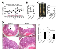 골수유래 세포의 TLR 3/7이 대장암 생성에 미치는 영향 연구