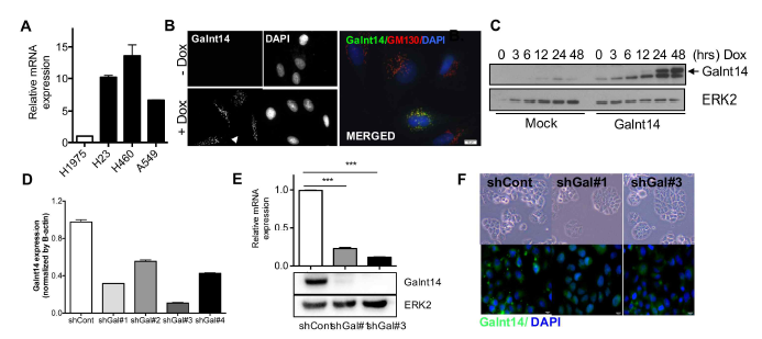 GALNT14 발현 조절 세포주 확립 (A) 폐암 세포주에서 GALNT14 발현 비교 (B) H1975세포주에 GALNT14 DOX inducible 세포주 확립 후 GALNT14 발현 확인 (C) 면역블랏팅을 통한 DOX 처리 시간에 따른 GALNT14 발현 (D)GALNT14 shRNA 가 도입된 H460 세포주에서 GALNT14 발현 확인 (E) GALNT14 발현 억제 효율이 높은 세포주에서 GALNT14 의 발현을 real-time PCR과 면역 블랏팅으로 확인 (F) GALNT14 Knockdown 세포주의 형광 현미경 image