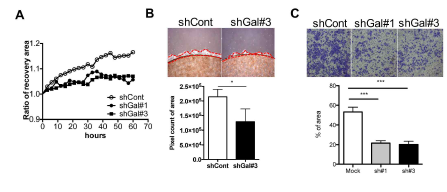 GALNT14 KD 세포주의 전이능 상실 검증 (A) Wound healing assay (B) Coverslip migration assay 를 통한 세포의 이동성 분석 (C) GALNT14 KD 세포의 침투성을 invasion assay를 통해 검증