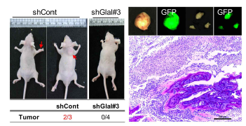 암의 전이 동물모델에서 GALNT14에 의한 전이 검증. 화살표는 골전이를 나타내며 골전이된 종양세포가 나타내는 GFP를 확인 (오른쪽)