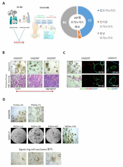 오가노이드 수립 및 조직과의 형태 및 병리학적 비교 (A) 오가노이드 수립 work flow (B) 조직과 오가노이드의 형태 및 병리학적 비교 (C) 오가노이드 확인을 위한 EpCAM/LGR5/DAPI Immuno-Fluorescence staining (D) 오가노이드 long-term culture 확인 및 SRCC 오가노이드 특징