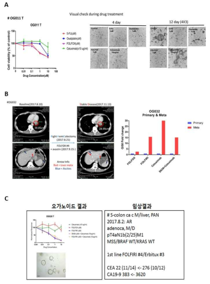 오가노이드 항암제 반응성 이중검증 및 환자에서의 항암제 반응성 양상 (A) 오가노이드 항암제 반응성 이중검증 (B) 전이된 대장암 환자 오가노이드의 항암제 반응성 양상 (C) 오가노이드와 동일환자 실제 임상결과