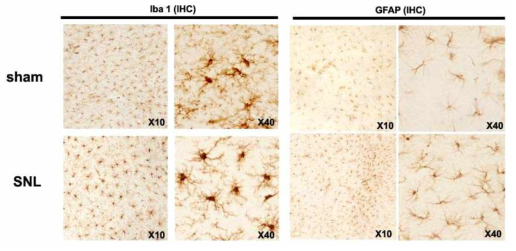 Expression of Iba1 and GFAP in the amygdala following SNL on postsurgery day 14