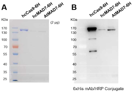 Western blot analysis를 통한 단백질 발현 확인