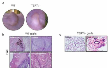 TERT-/-배아줄기세포주의 테라토마 형성능 비교