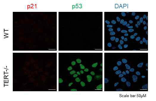 p53/p21의 면역염색 결과