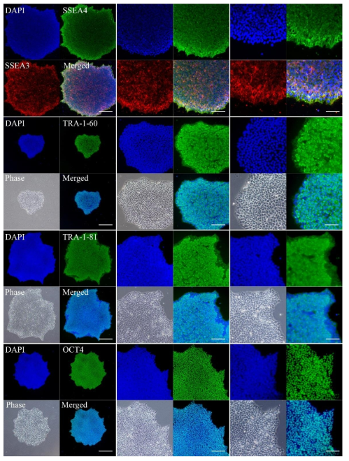 Expression of pluripotency marker of generated iPSC. The fibroblast-derived iPSCs showed positive result when stained by pluripotency marker SSEA3, SSEA4, TRA-1-60, TRA-1-81, OCT4, top to bottom. Scale bars indicate from left to right 175 μm, 75 μm, 37,5 μm, respectively