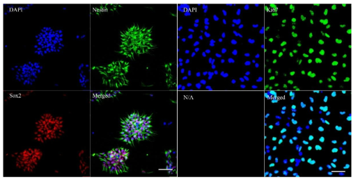 iPSC-derived NSC expresses strong NSC and proliferation marker in a pure culture. iPSC cells were induced by Dorsomorphin and SB431542 for 12 days and cells were dissociated for FACS analysis. After FACS cells were cultured for additional 2 passages and stained with NSC marker Nestin and Sox2 (left) and proliferation marker Ki67 (right). Scale bar indicates 62.5 μM