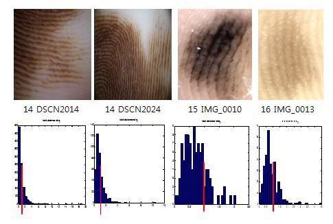 다른 Nevus 데이터를 인가하였을 때 히스토그램 결과