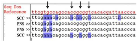 Adjacent “N” points such as 888, 896, 899, 902 in the 12S ribosomal RNA portion compared to the peri-lesional normal skin. 인접한 부위가 “N” 으로 관측되어 이 부분이 deletion된 mtDNA copy number를 확인하는 것이 필요할 것으로 예상하였음. SCC: Squamous cell carcinoma, PNS: Peri-lesional normal skin