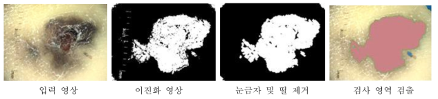 진단 영역 검출