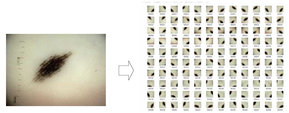 학습 영상과 영상 회전/이동/corp에 의한 data augmentation