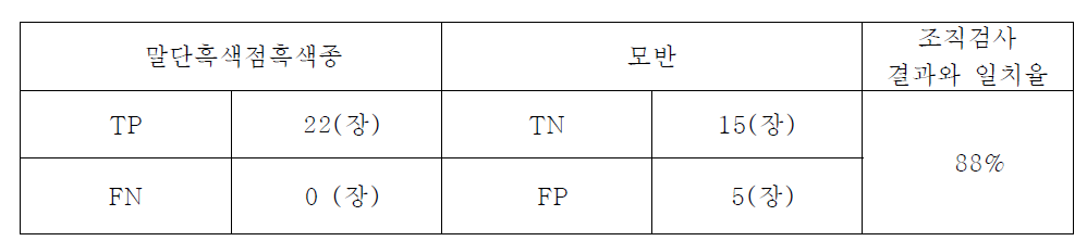 조직검사 결과와 일치율