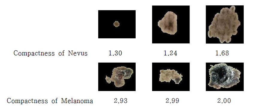 병변 분할영상과 Compactness